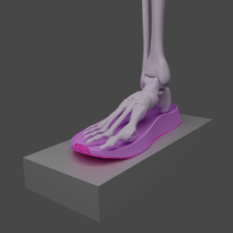 Concept 1